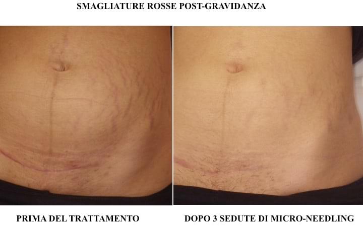 Dermatologia estetica Milano