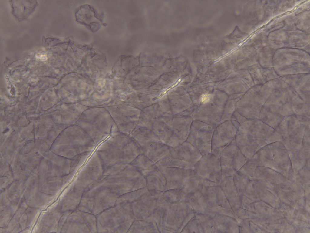 Esame micologico a microscopio in contrasto di fase in un caso di micosi presso Studio Medico Serini, dermatologo Milano