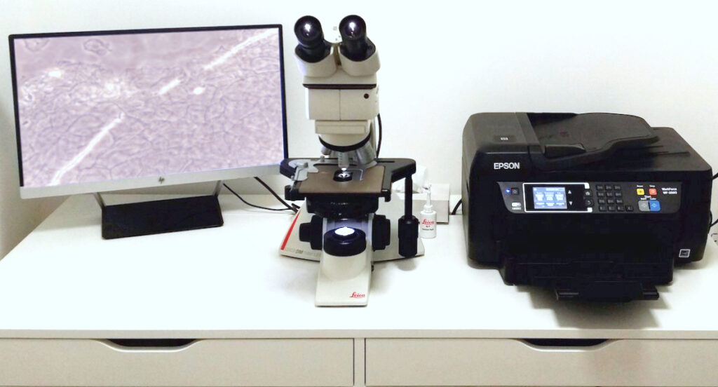 Apparecchiatura per esame micologico a Milano presso Studio Medico Serini: microscopio digitale, monitor e stampante