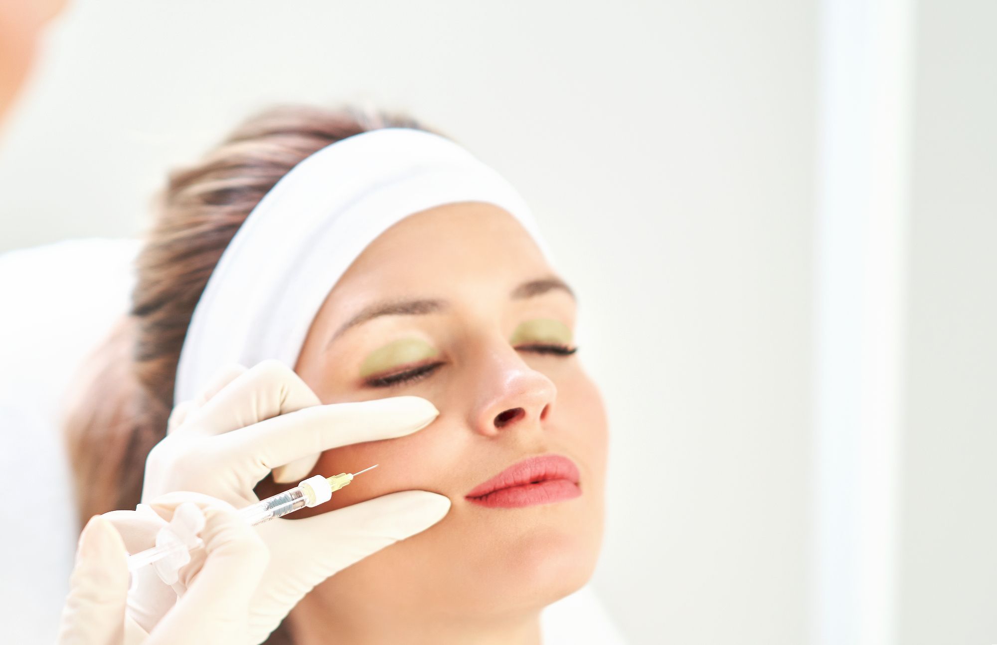 Donna che si sottopone a biorivitalizzazione viso mediante iniezione di acido ialuronico nella pelle di una guancia